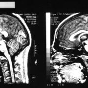 Pinker's Brain